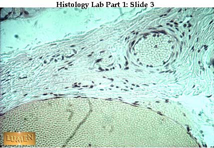 lumen are lood cells. blood cells histology. lumen are lood cells.