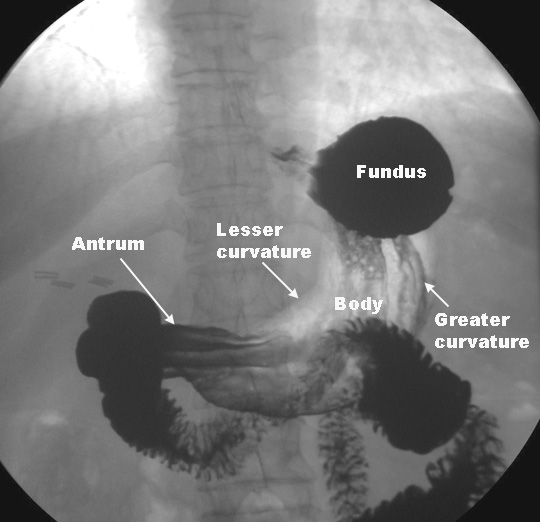 The human esophagus is about 10 in