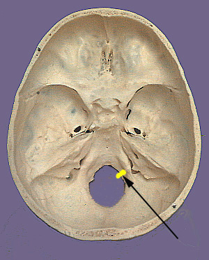 Cranium CN XII