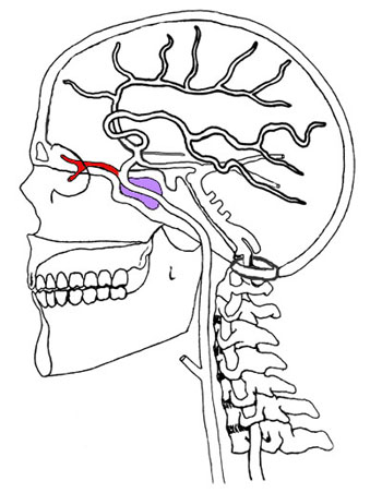 Cervical Carotid