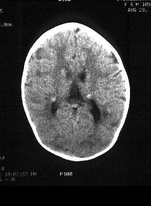 Case 5 - CT