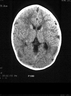 Case 5 - CT