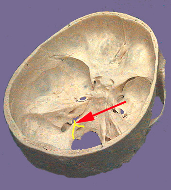 Nervio espinal accesorio