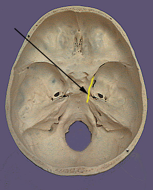 oculomotor nerve superior orbital fissure