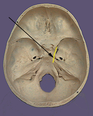 Cranium CN III