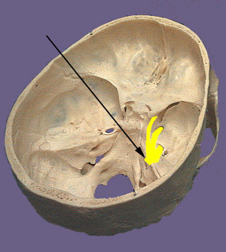 Cranium CN V