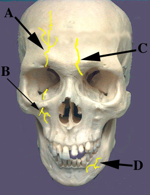 Nerves Front View of Skull
