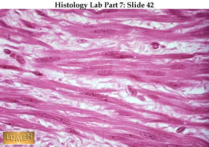 Skeletal Muscle Labeled Microscope