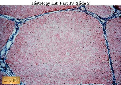 histology slides 1 liver histology labeled