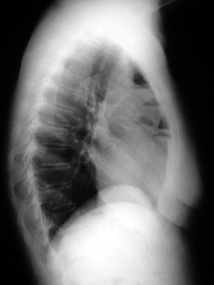 ��: Case Week ���� ������� 
