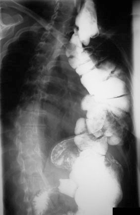 ��: Case Week ���� ������� 