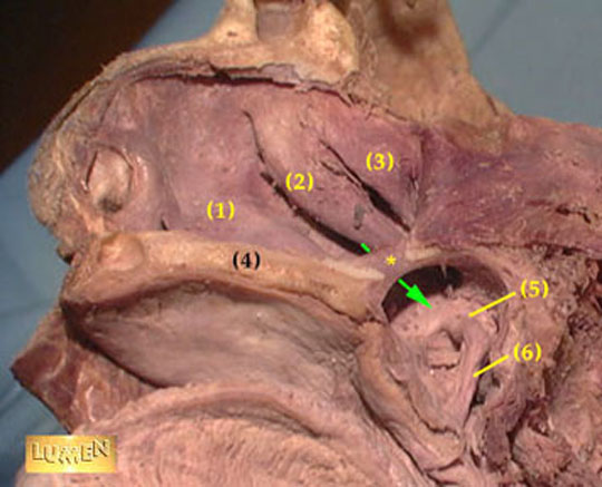 Maxillary Sinus