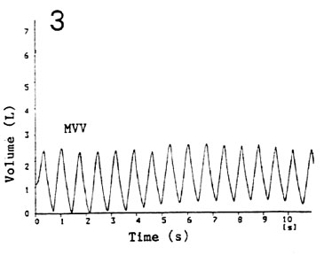 physio3.jpg (15242 bytes)