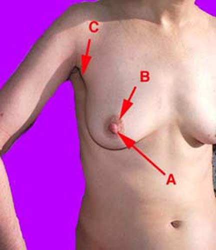 Average Breast Pics