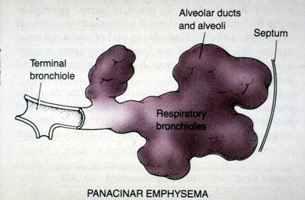 drug delivery to the lung lung biology in health and disease