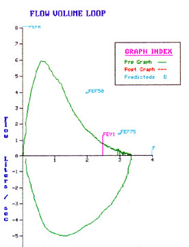 Normal Peak Flow Rate Chart