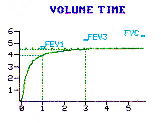 Predicted Fev1 Chart