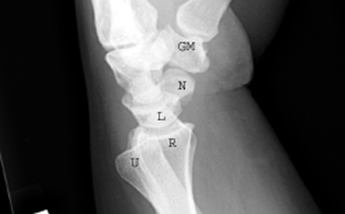 Try to identify the following