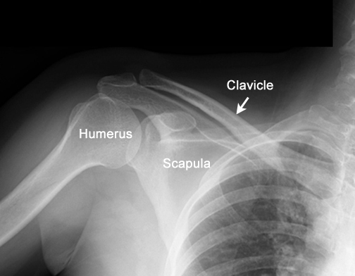 Try to identify the following