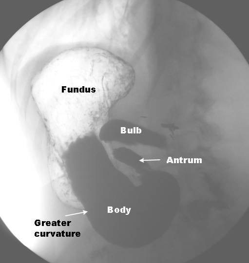 Course of Esophagus