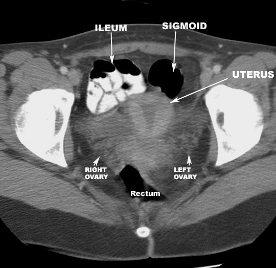 Course of Esophagus