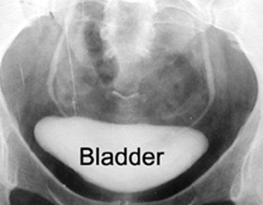 GU Radiologic Anatomy