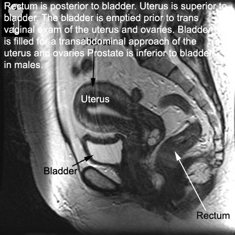 Technology and Techniques in Radiology: Rectum, Bladder, Uterus in MR