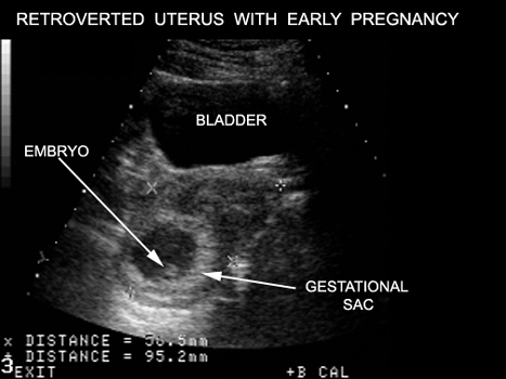 Mammography objectives