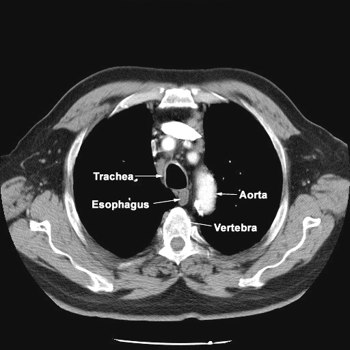 Course of Esophagus