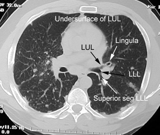 Locate portions of Aorta
