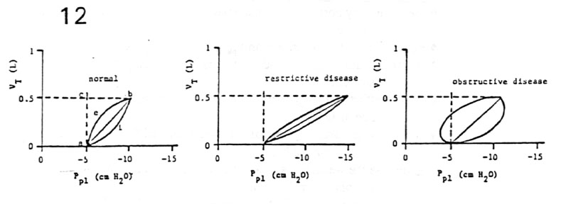 Mechanics of Breathing