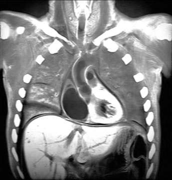 bony thorax diagram. a Withschematic diagram of