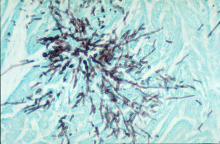 candidiasis in animals