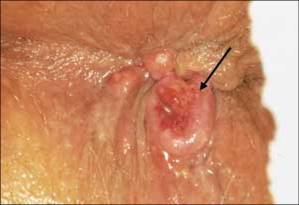 Erica Lauren Mature Anal Excrutiating Pain During Anal Sex