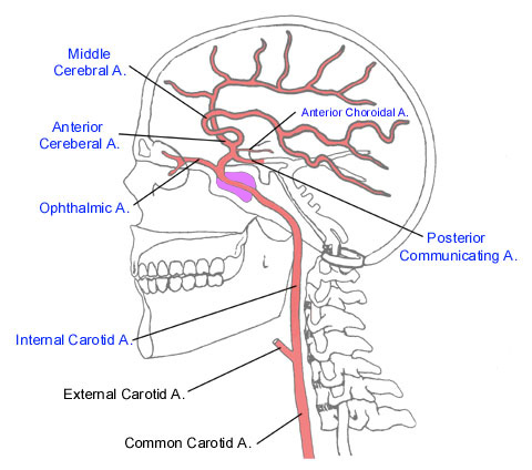 Move the cursor along the course of the internal carotid artery and its 