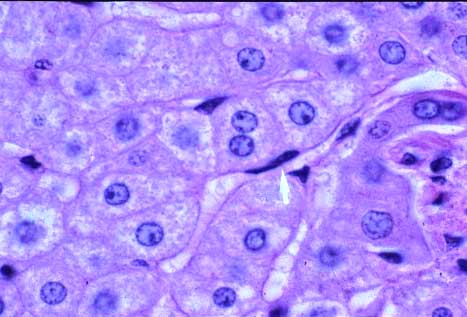 Liver Muralium
