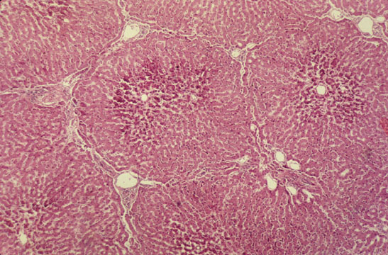 What's All This Pink & Purple?!? (Histology Slideshow) Quiz - By sbme