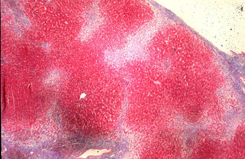 Li 11
