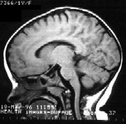 Case 3 - MRI