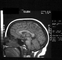 MRI - Case 2