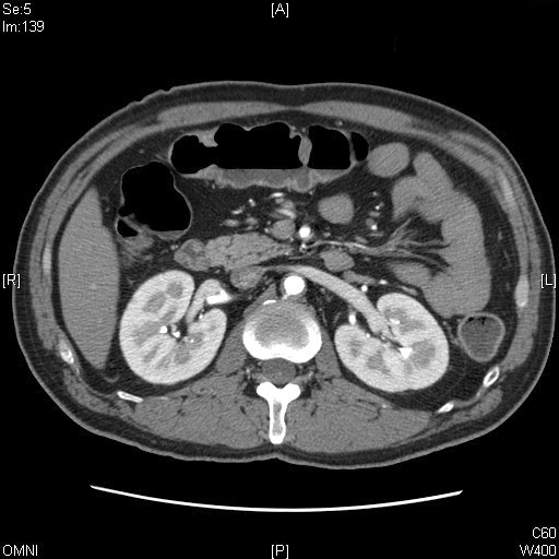 Labeled Abdominal Ct