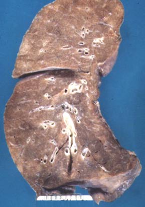 Cut surface of normal lung.