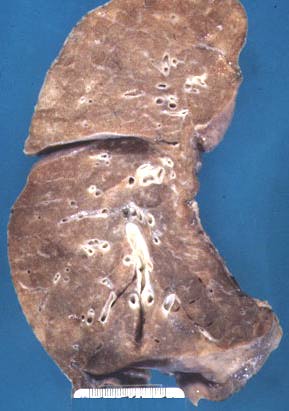 Pathology Outlines - Normal anatomy