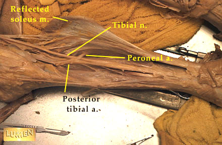Posterior Thigh and Leg 4 Dissection