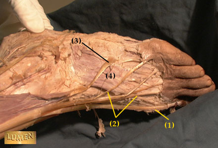 extensor hallucis longus. 1  extensor hallucis longus