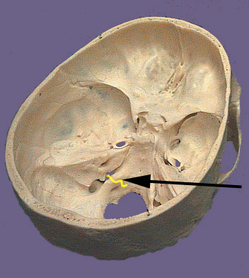Cranium CN X