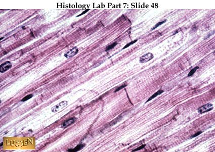 cardiac muscle striations