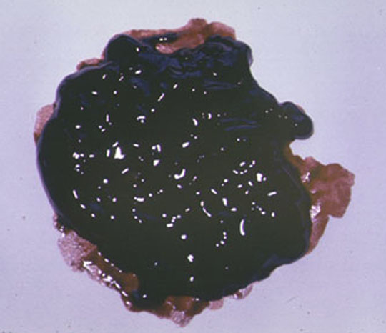 http://www.meddean.luc.edu/lumen/meded/mech/cases/case10/gi21.jpg