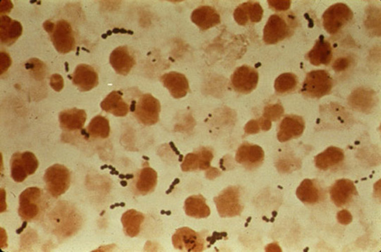 staphylococcus aureus gram stain. Streptococcus Pyogenes: A gram
