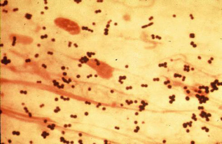 images staph aureus gram stain
